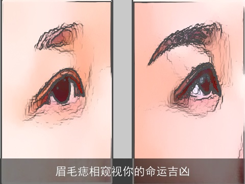 眉毛痣相窥视你的命运吉凶