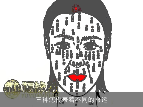 三种痣代表着不同的命运