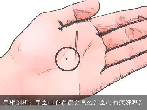 手相剖析：手掌中心有痣会怎么？掌心有痣好吗？