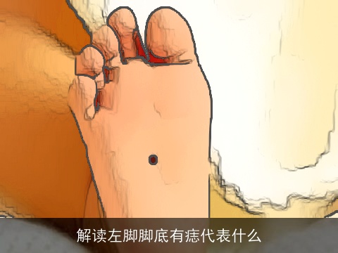 解读左脚脚底有痣代表什么