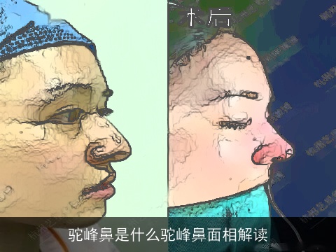 驼峰鼻是什么驼峰鼻面相解读