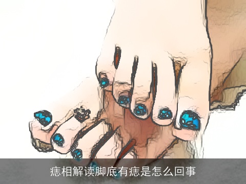 痣相解读脚底有痣是怎么回事