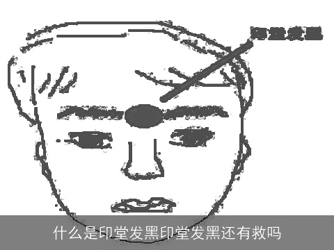 什么是印堂发黑印堂发黑还有救吗