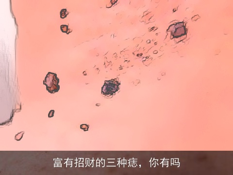 富有招财的三种痣，你有吗