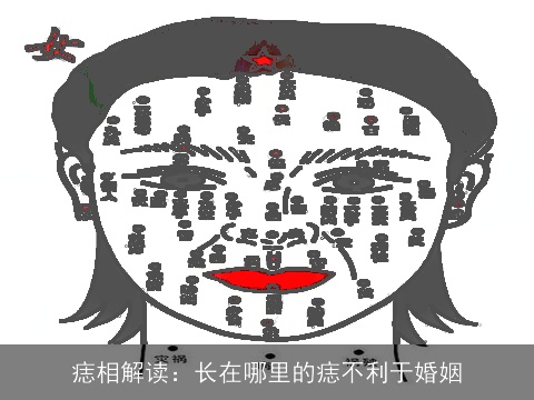 痣相解读：长在哪里的痣不利于婚姻