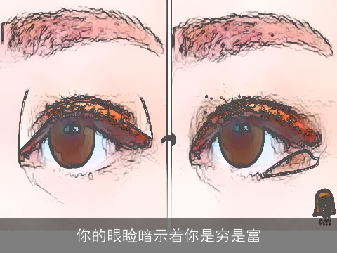 你的眼睑暗示着你是穷是富