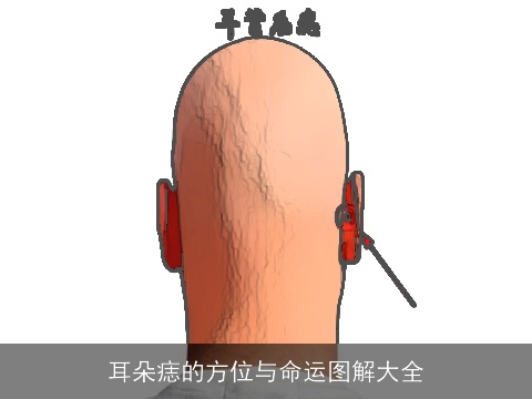 耳朵痣的方位与命运图解大全