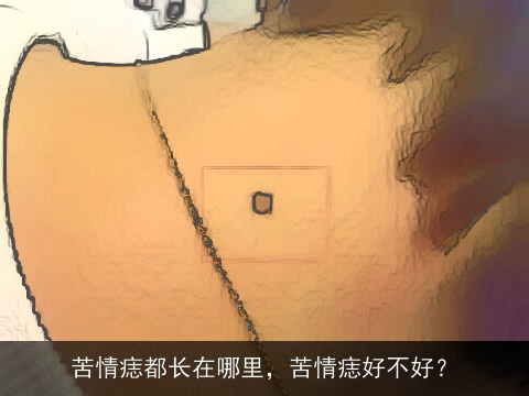 苦情痣都长在哪里，苦情痣好不好？