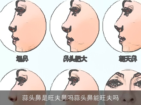 蒜头鼻是旺夫鼻吗蒜头鼻能旺夫吗