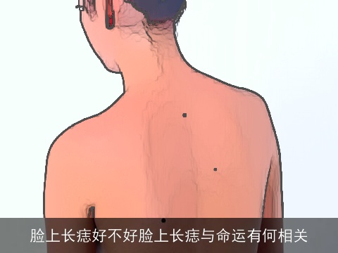 脸上长痣好不好脸上长痣与命运有何相关