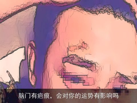 脑门有疤痕，会对你的运势有影响吗