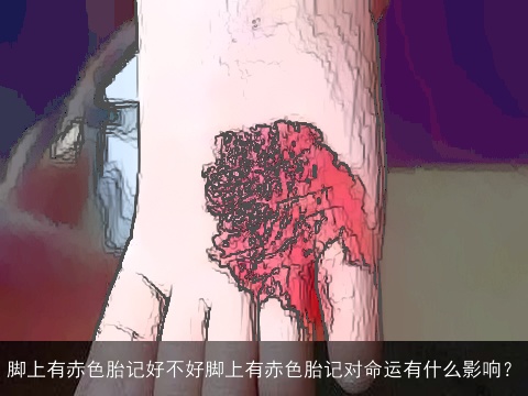 脚上有赤色胎记好不好脚上有赤色胎记对命运有什么影响？