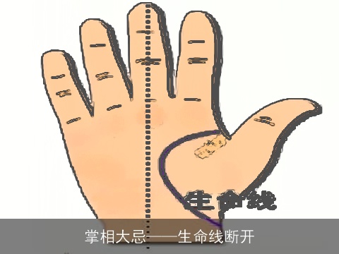 掌相大忌——生命线断开