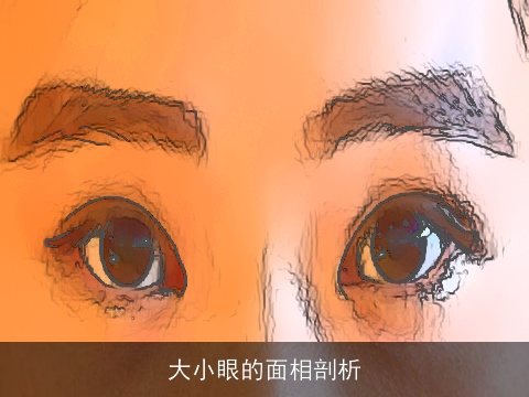 大小眼的面相剖析