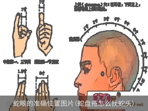 蛇眼的准确位置图片(蛇盘疮怎么找蛇头)