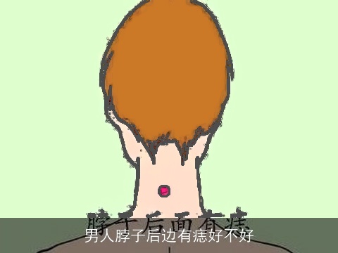 男人脖子后边有痣好不好