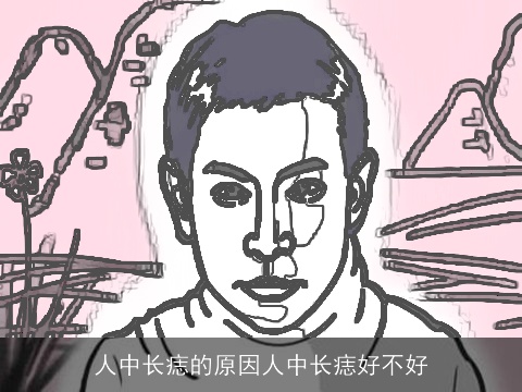 人中长痣的原因人中长痣好不好