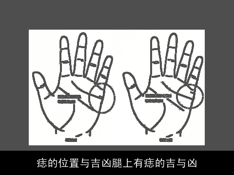 痣的位置与吉凶腿上有痣的吉与凶