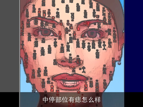 中停部位有痣怎么样
