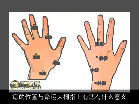痣的位置与命运大拇指上有痣有什么意义